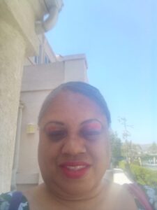 Lasonia Foster